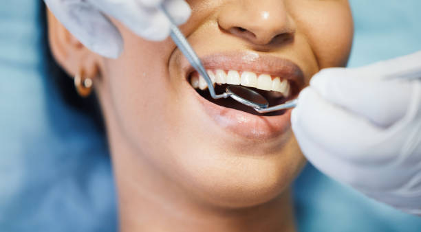 Best Emergency Dentist for Knocked-Out Tooth in Estell Manor, NJ